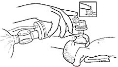  Figur 2    Ventilering med selvoppbl&aring;sbar bag og maske (3)