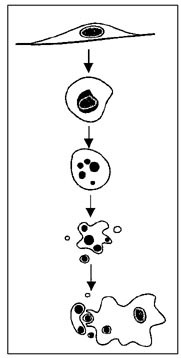 Figur 1    Skjematisk fremstilling av apoptoseprosessen. Cellen mister kontakt med andre celler og med basalmembranen,&hellip;