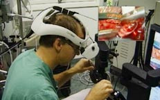 Figur 3    Operasjon med roboten Zeus. Kirurgen sitter ved siden av operasjonsbordet og styrer tre robotarmer. Armen som&hellip;