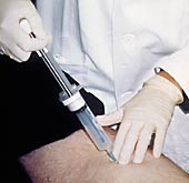 Figur 1    Finn&aring;lspunksjon av palpabel tumor p&aring; l&aring;ret. Ved &aring; trekke opp stempelet i aspirator samtidig som n&aring;len f&oslash;res frem&hellip;