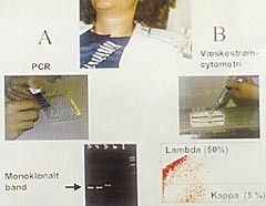 Figur 6    Utredning av pasient med palpabel kul p&aring; halsen. Forel&oslash;pig vurdering av Diff-Quick-farget utstryk har avdekket&hellip;