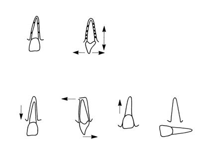 Figur 3  Klassifikasjon av skader i tannens st&oslash;ttevev (periodontiet) som benyttes ved Avdeling for pedodonti og atferdsfag,&hellip;