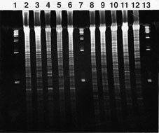 Figur 2 viser resultat fra restriksjonsenzymanalyser av A baumannii-isolater. Bane 1, 7 og 13 er standarder. Bane 2 &ndash; 5 &hellip;