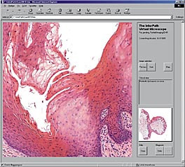 Figur 5    Valgt omr&aring;de av interesse i InterPath
