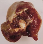  Figur 2    Foto av gjennomsk&aring;ret myksom. Karakteristisk er den gel&eacute;aktige konsistensen