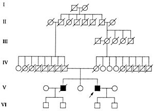 Figur 1    Familiekart for to br&oslash;dre med polycystisk lipomembran&oslash;s osteodysplasi med skleroserende leukoencefalopati&hellip;