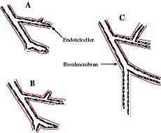  Figur 2    Skjematisk fremstilling av utvikling ved angiogenese. A: tidlig stadium. B og C: senere stadium