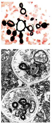  Figur 2a    Soppelement med smalhalset knoppskyting (lysmikroskopi, Grocotte,