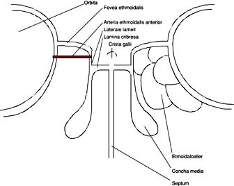  Figur 4    Skjematisk fremstilling av etmoidaltaket og dets omgivelser. Bemerk relasjonen mellom a. ethmoidalis anterior og&hellip;