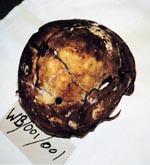 Skallen til en ca. 50 &aring;r gammel mann med hele tre kulehull. To av dem sitter s&aring;pass h&oslash;yt oppe p&aring; issen og med forholdsvis&hellip;