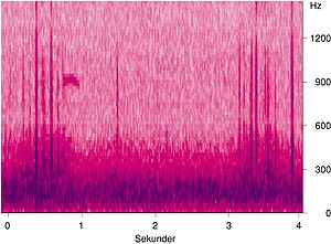  Figur 4    Spektrogram som viser to inspirier atskilt av en ekspirasjonsfase hos en pasient med kronisk obstruktiv&hellip;