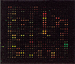 Figur 4  Utsnitt av en mikromatrisestudie av liposarkomceller i kultur. Fors&oslash;ket viser i r&oslash;dt gener som induseres av en&hellip;