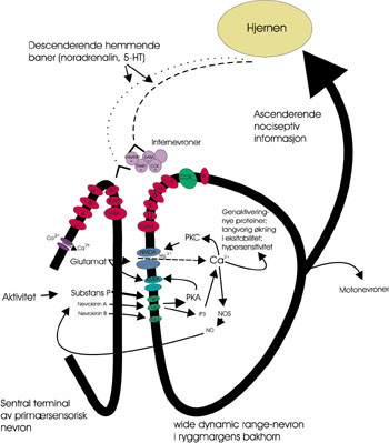 Figur 3   Ved &oslash;kt sensitivitet i nociseptive nevroner i ryggmargens bakhorn vil signaler fra periferien overf&oslash;res i st&oslash;rre&hellip;