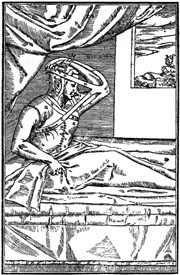 Figur 4   Hudlappen er sydd fast til nesen og armen immobilisert ved hjelp av et sinnrikt bandasjesystem. Tresnitt fra&hellip;