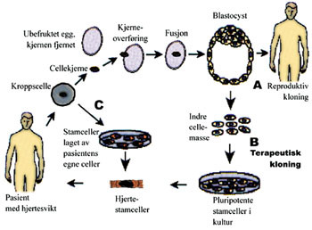 Figur 4   Produksjon av vevsforlikelige stamceller. A: ved reproduktiv kloning (kopi individ)  B: ved terapeutisk kloning  C&hellip;
