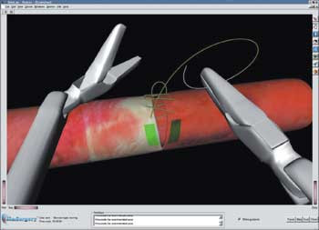 Simulatorbilde fra trening p&aring; karanastomoser. Kirurgen bruker spaker med samme form og presisjon som instrumenter i en&hellip;