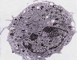 Figur 2   Elektronmikroskopisk bilde av vevsmakrofag. Den l&oslash;se kromatinstrukturen tyder p&aring; aktiv transkripsjon. Lyse&hellip;