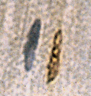 Figur 2 Apoptose av en hjertemuskelcelle p&aring;vist med histokjemisk teknikk. Til venstre sees cellekjernen til en levende&hellip;