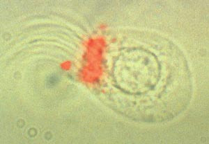 En enkelt ependymalcelle fra en av hjernens ventrikler. Denne celletypen er sentralnervesystemets egen stamcelle. Foto Neuro&hellip;