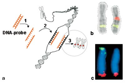 Figur 2  a) Skjematisk illustrasjon av prinsippet for FISH. En dobbeltr&aring;det DNA-probe er merket med et fluorescerende stoff&hellip;
