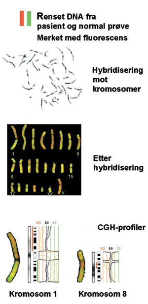 Figur 4  Skjematisk illustrasjon av prinsippet for komparativ genomisk hybridisering (CGH). Metoden viser tap eller&hellip;