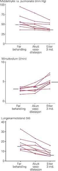 Hemodynamikk hos pasienter oppfattet som ikke-respondere ved akutt vasodilatasjonstesting og etter tre m&aring;neders behandling&hellip;