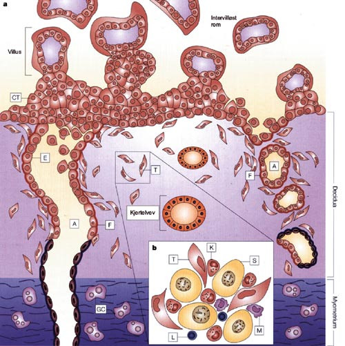 Figur 2  Trofoblastinvasjon i overgangssonen mellom f&oslash;talt og maternelt vev (4). a) Vill&oslash;se cytotrofoblaster (CT) vokser ut&hellip;