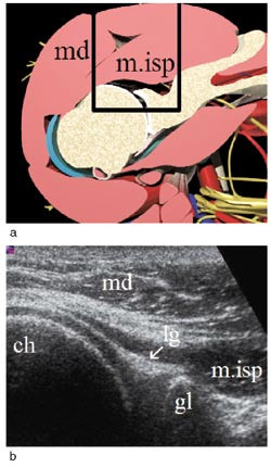 Figur 6  Dorsal-transversal projeksjon: a) Aksialt snitt gjennom skulderleddet. Det avmerkede omr&aring;det tilsvarer&hellip;