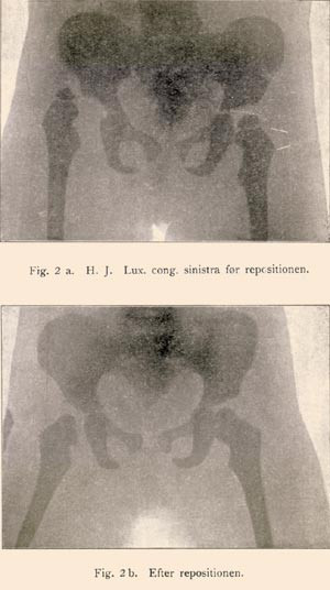 Artikkelen om &laquo;senetransplantasjoner og den ublodige behandling etc.&raquo; ble illustrert med r&oslash;ntgenbilder, og det bare ni &aring;r&hellip;