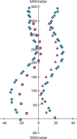 Figuren viser digitalisering av mark&oslash;rene som ble satt p&aring; hvert r&oslash;ntgenbilde. Det er fire bl&aring; markeringer per ryggvirvel som&hellip;