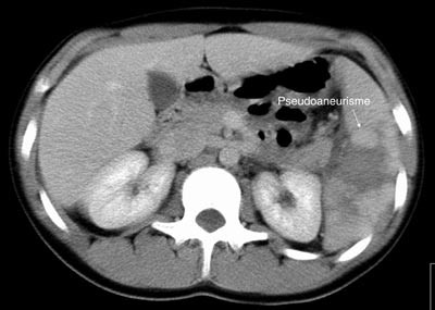 Figur 2b  Samme som figur 2a, men i ven&oslash;s kontrastfase