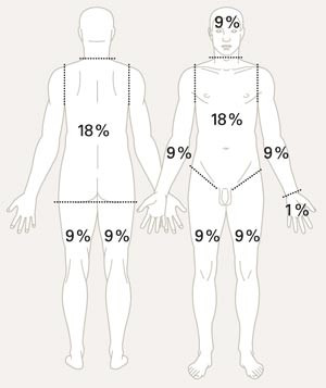 Arealberegning: &laquo;9-regelen&raquo;