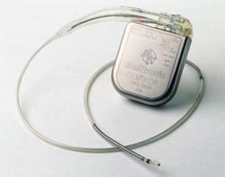 Det er ikke dokumentert nytte av profylaktisk innleggelse av defibrillator etter hjerteinfarkt. Foto Medtronic
