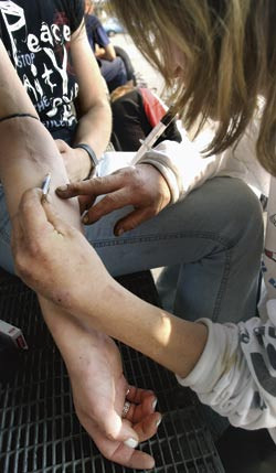 Det ansl&aring;s &aring; v&aelig;re mellom 10 000 og 15 000 injiserende rusbrukere i Norge. Foto Heiko Junge/SCANPIX