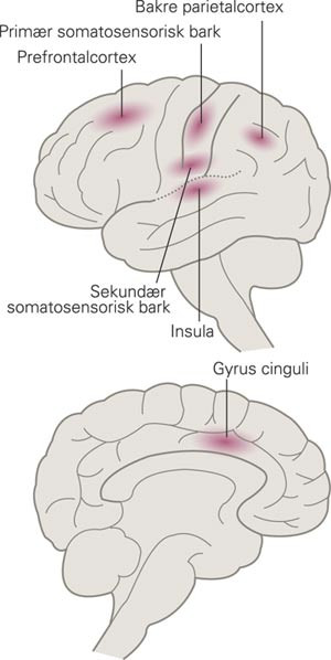 Omr&aring;der i hjernebarken som viser &oslash;kt aktivitet ved subjektiv smerteopplevelse. Figuren er basert p&aring; Peyron og medarbeidere &hellip;