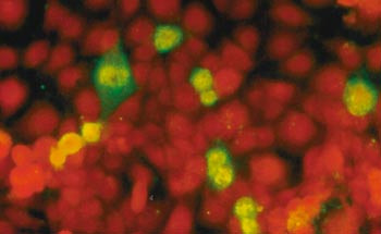 Figur 2  LLC-MK2-cellekultur infisert med humant metapneumovirus. Indirekte immunflourescensp&aring;visning med polyklonalt anti&hellip;