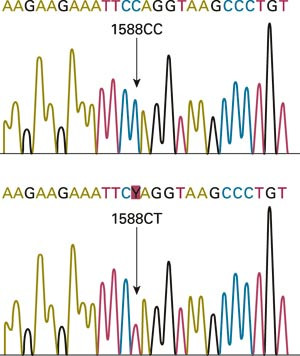 Mutasjonen Q530X i KCNQ1 identifisert ved DNA-sekvensering. Mutasjonen Q530X inneb&aelig;rer at nukleotid 1588 i ekson 12 i KCNQ1&hellip;