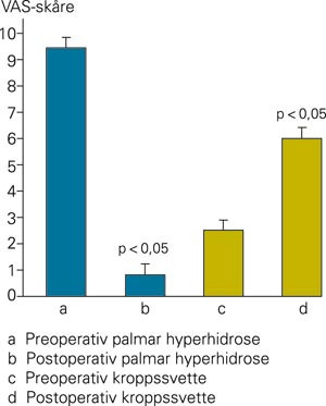 Effekten av torakoskopisk sympatektomi p&aring; palmar hyperhidrose. Endring i plager p&aring; en visuell analog skala etter&hellip;