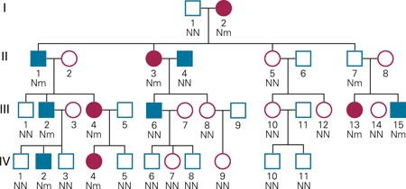 Eksempel p&aring; familietre ved monogen diabetes. Diabetes (fylte symboler) forekommer i flere generasjoner, b&aring;de hos kvinner &hellip;
