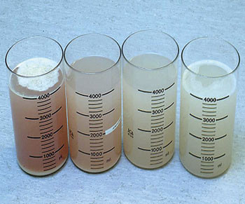 Figur 3  Bronkoalveol&aelig;r skyllev&aelig;ske fra pasient med alveol&aelig;r proteinose. Bildet viser de f&oslash;rste tre karene med skyllev&aelig;ske&hellip;