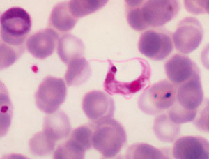 Figur 2  Trypanosoma cruzi i perifert blod. Foto LL Moore, Public Health Image Library, CDC, USA