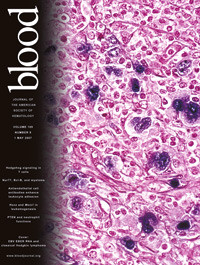 Artikkelen ble publisert 1.8. 2007 i det prestisjetunge tidsskriftet Blood (www.bloodjournal.org). &copy; American Society of&hellip;