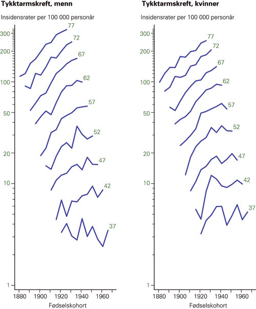 Figur 4  Insidensrate av tykktarms- og endetarmskreft over f&oslash;dselskohort etter fem&aring;rs aldersgrupper, kvinner og menn 35&thinsp;&ndash;&thinsp;79&hellip;