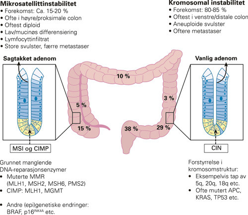 Figur 5 Kliniske, patologiske og molekyl&aelig;re kjennetegn ved kolorektal kreft.Proksimal og distal tykktarmskreft har s&aelig;regne&hellip;
