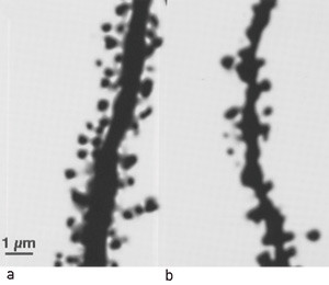 Figur 2  a) Et st&oslash;rre antall spinae (utl&oslash;pere fra dendritter) p&aring; dendritt i hippocampus fra trent dyr sammenliknet med b)&hellip;