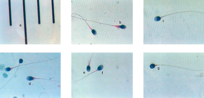 Figur 2  Spermiemorfologi. Spermier farget med Papanicolaou-fargel&oslash;sning for spermier (6). a &ndash; skala, distanse mellom&hellip;