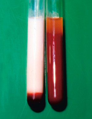 Figur 3  Blakket serum. Foto Knut Nordstoga, Norges veterin&aelig;rh&oslash;gskole