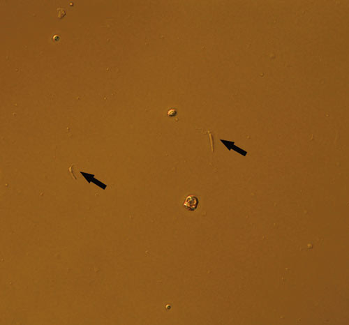 Figur 2  Kultur fra beinmargsaspirat (v&aring;tpreparat, x 400): 8&thinsp;&ndash;&thinsp;10 &micro;m store stavformede leishmaniapromastigoter med flagell