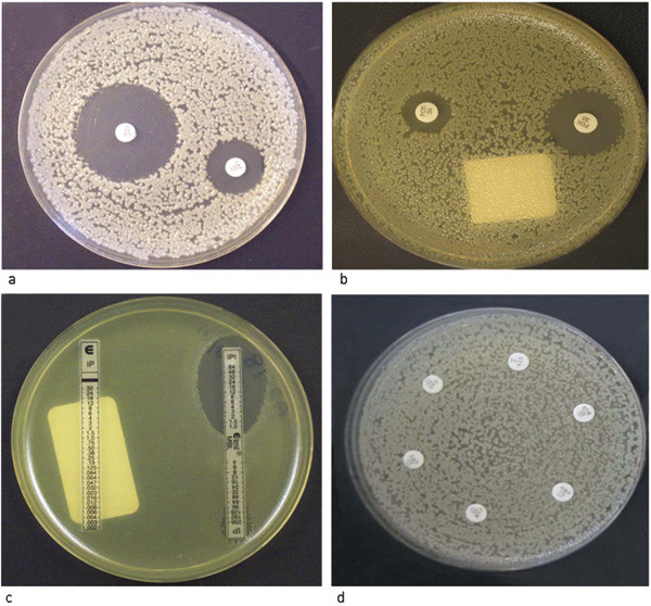 Figur 3  a) P&aring;visning av ekstendert spektrum-betalaktamaseproduserende Escherichia coli der veksthemningssonen for&hellip;