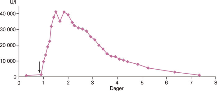 Figur 3 Forl&oslash;p av kreatinkinase (CK) gjennom sykehusoppholdet. Den f&oslash;rste pr&oslash;ven er tatt preoperativt, den andre&hellip;